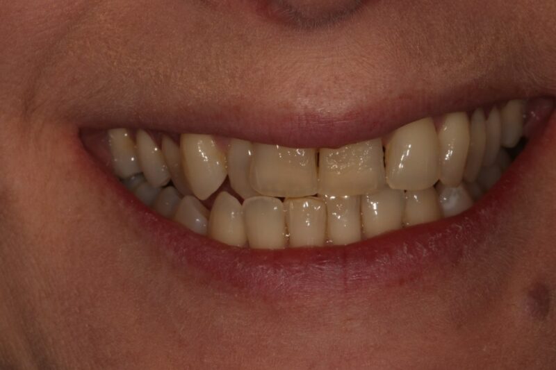 Before - Cheadle Hulme Dental