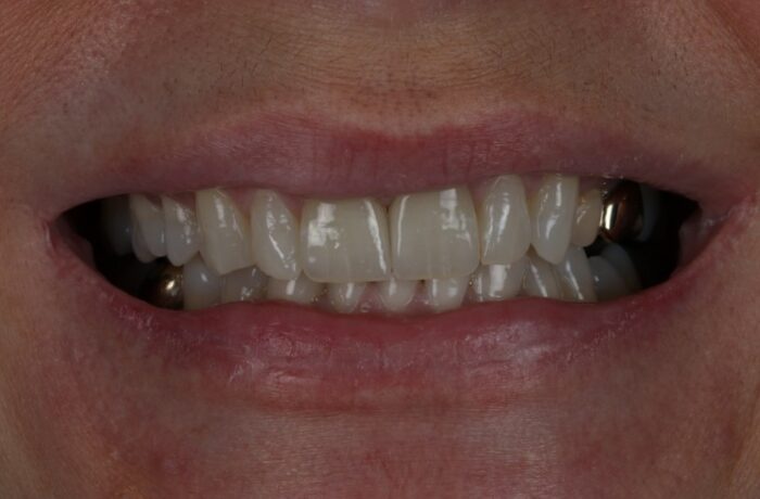 After - Cheadle Hulme Dental