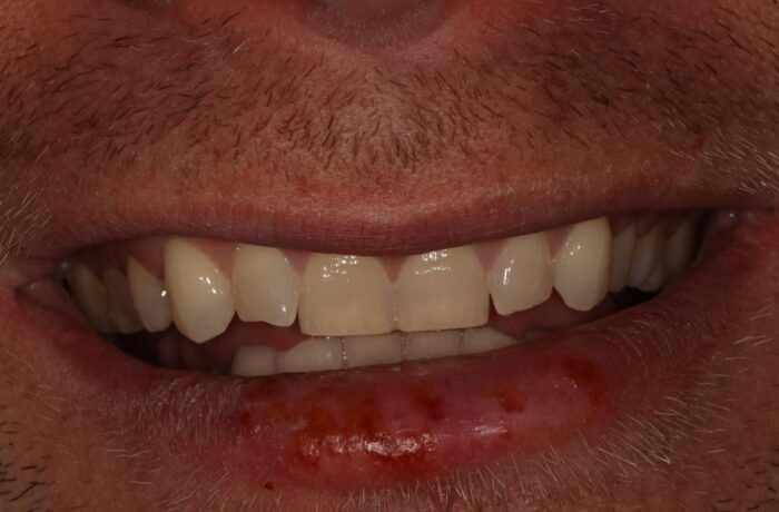 Before - Cheadle Hulme Dental