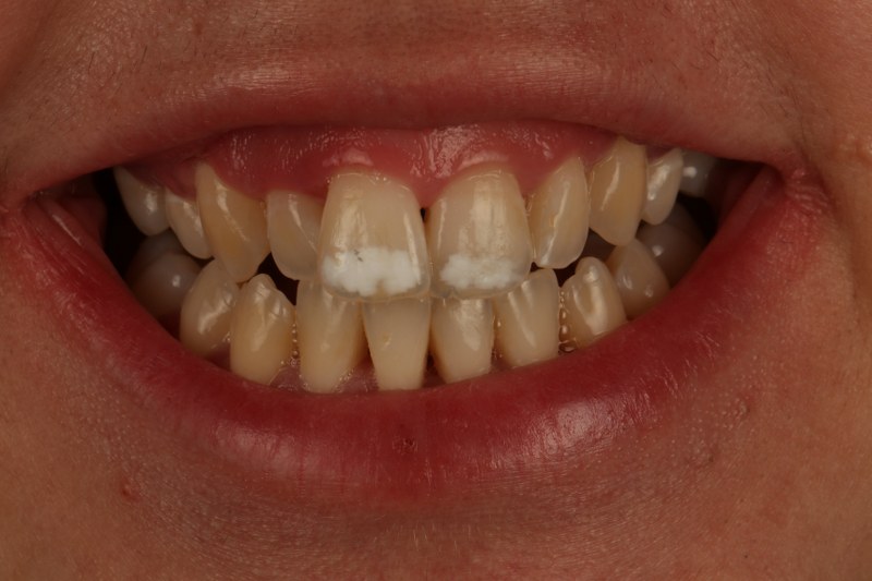 Before - Cheadle Hulme Dental