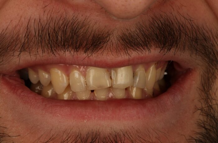 Before - Cheadle Hulme Dental