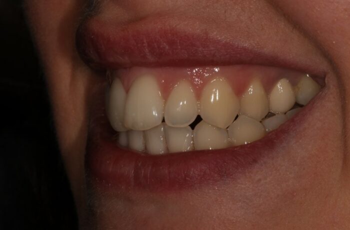 Before - Cheadle Hulme Dental