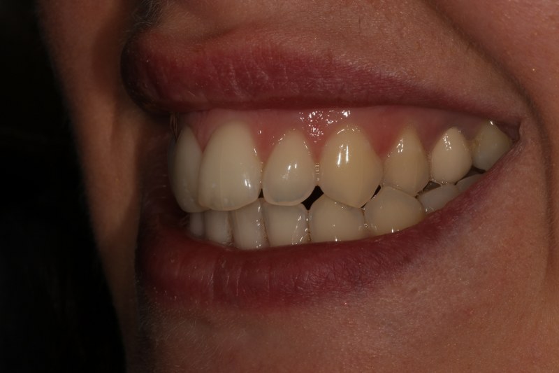 Before - Cheadle Hulme Dental