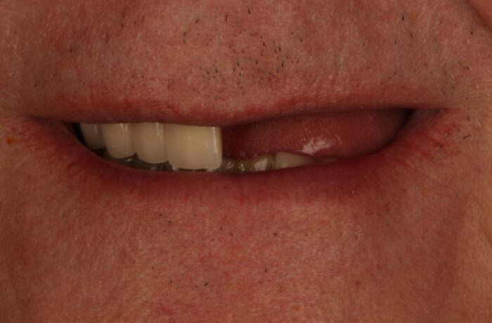 Before - Cheadle Hulme Dental