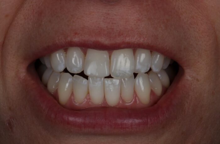 After - Cheadle Hulme Dental