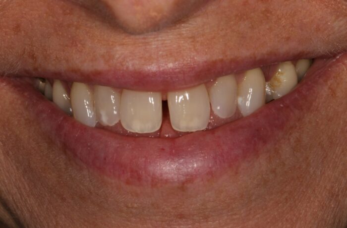 Before - Cheadle Hulme Dental