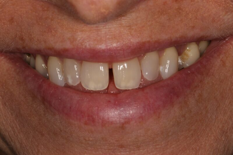 Before - Cheadle Hulme Dental
