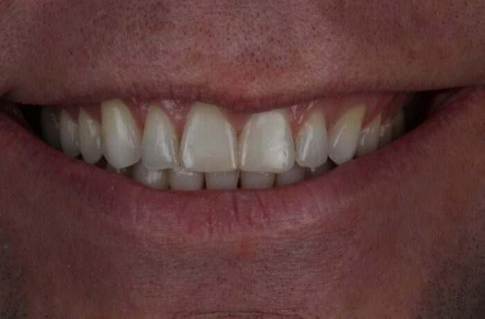 After - Cheadle Hulme Dental