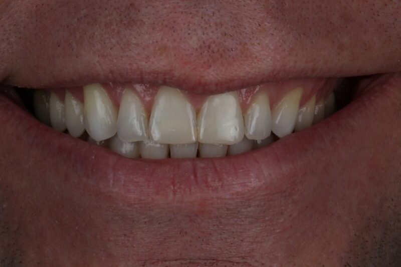 After - Cheadle Hulme Dental