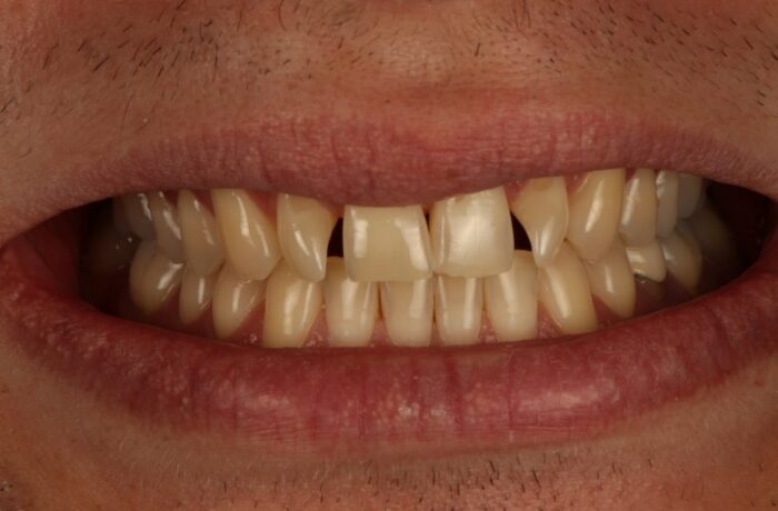 Before - Cheadle Hulme Dental