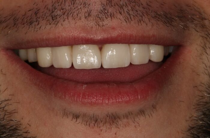 After - Cheadle Hulme Dental