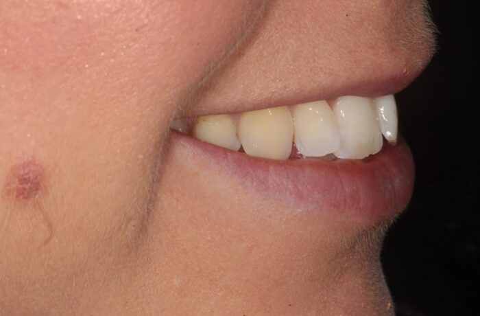 Before - Cheadle Hulme Dental
