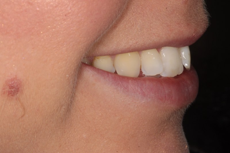 Before - Cheadle Hulme Dental