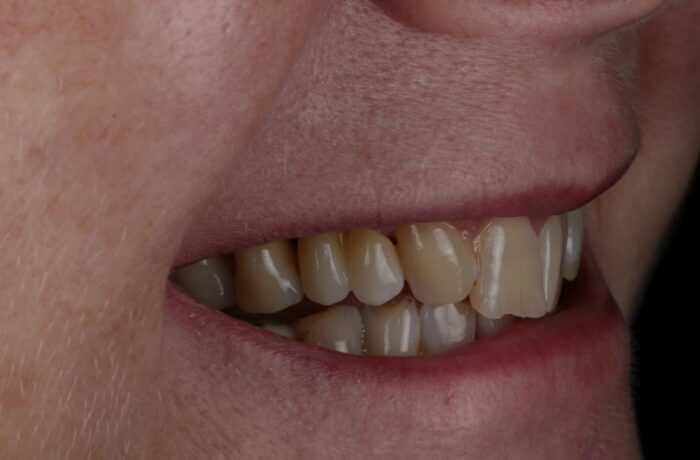 After - Cheadle Hulme Dental