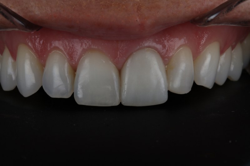 After - Cheadle Hulme Dental