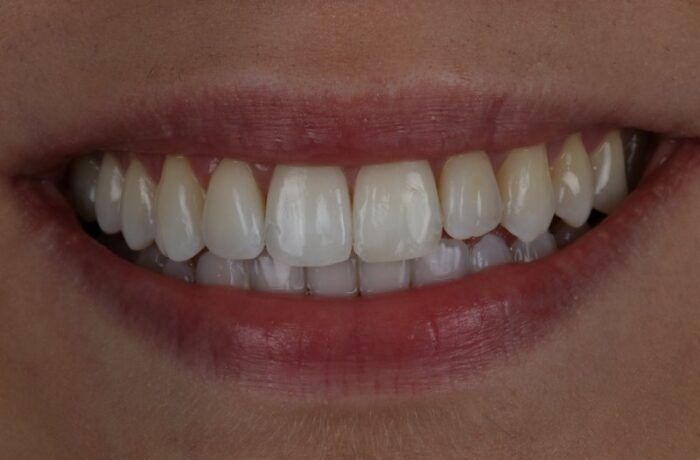 After - Cheadle Hulme Dental