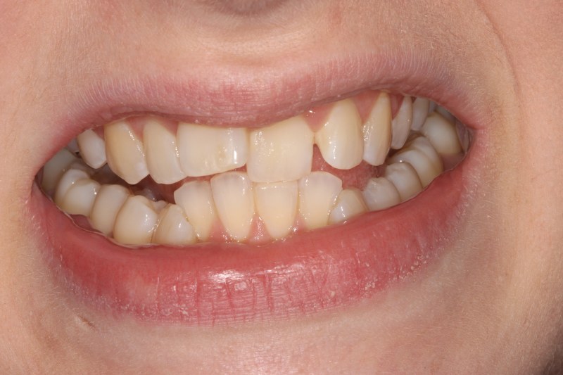 Before - Cheadle Hulme Dental