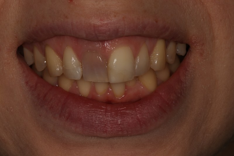 Before - Cheadle Hulme Dental