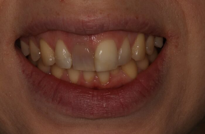 Before - Cheadle Hulme Dental