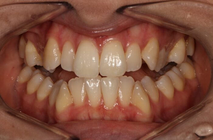 Before - Cheadle Hulme Dental