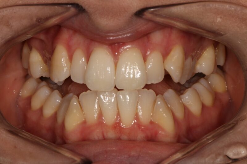 Before - Cheadle Hulme Dental