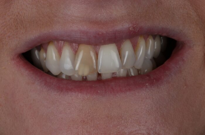 Before - Cheadle Hulme Dental