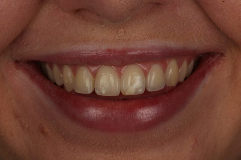 Before - Cheadle Hulme Dental