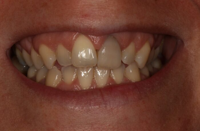 Before - Cheadle Hulme Dental