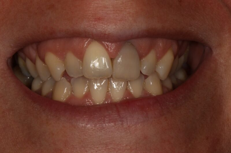 Before - Cheadle Hulme Dental