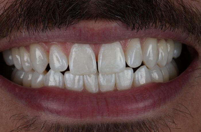 After - Cheadle Hulme Dental