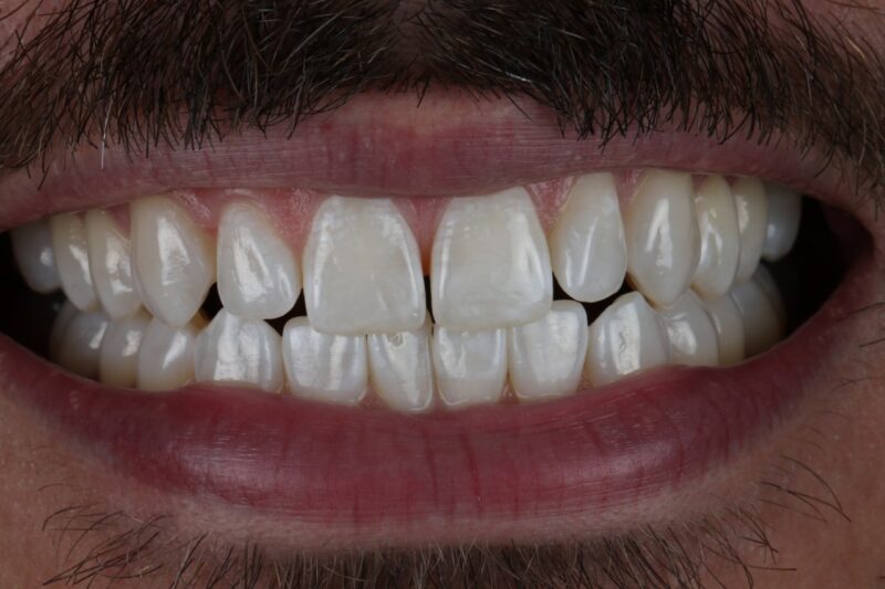 After - Cheadle Hulme Dental