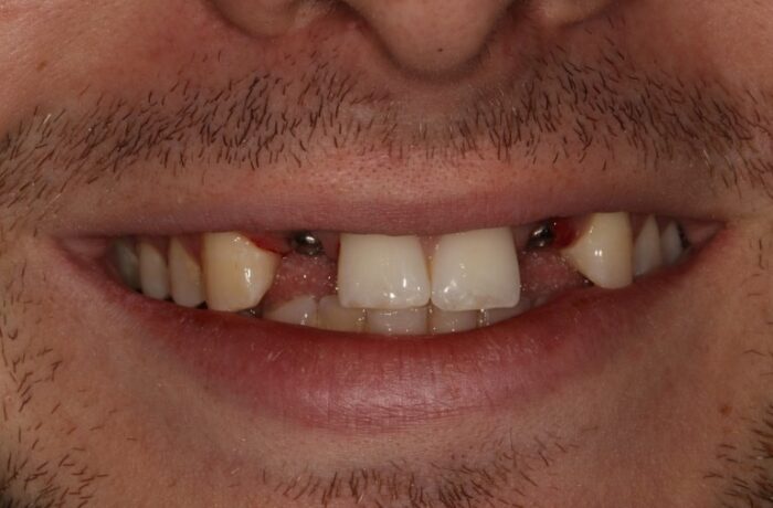 Before - Cheadle Hulme Dental