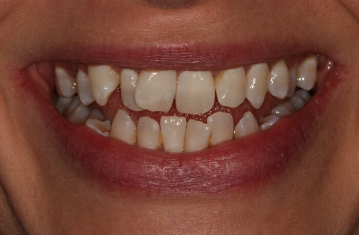 Before - Cheadle Hulme Dental