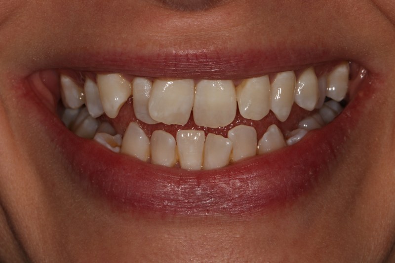 Before - Cheadle Hulme Dental