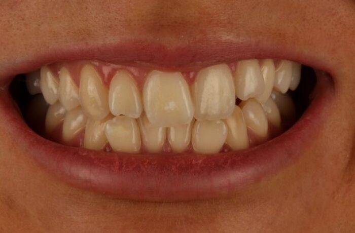 Before - Cheadle Hulme Dental