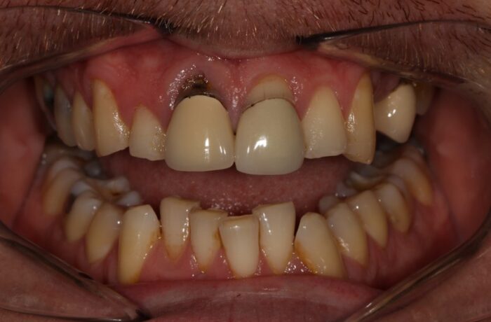 Before - Cheadle Hulme Dental