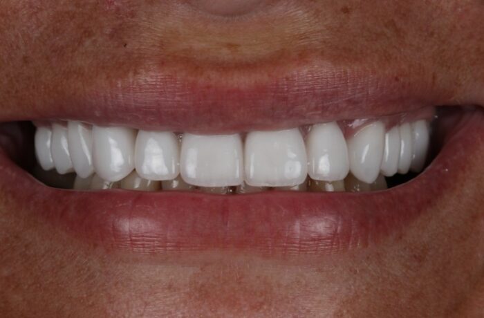 After - Cheadle Hulme Dental