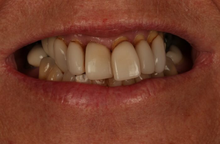 Before - Cheadle Hulme Dental
