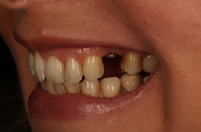 Before - Cheadle Hulme Dental