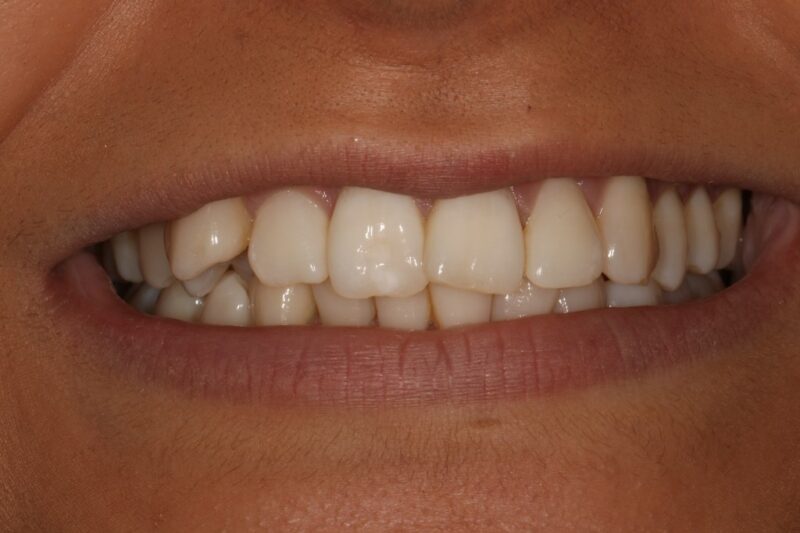 Before - Cheadle Hulme Dental