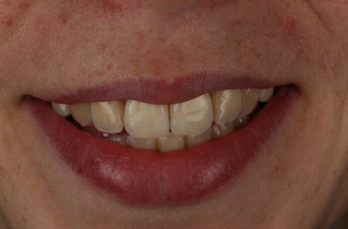 After - Cheadle Hulme Dental