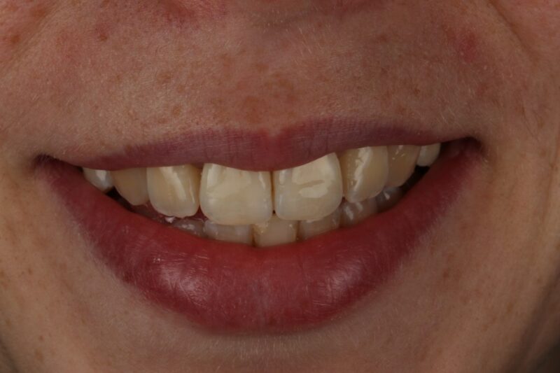 After - Cheadle Hulme Dental