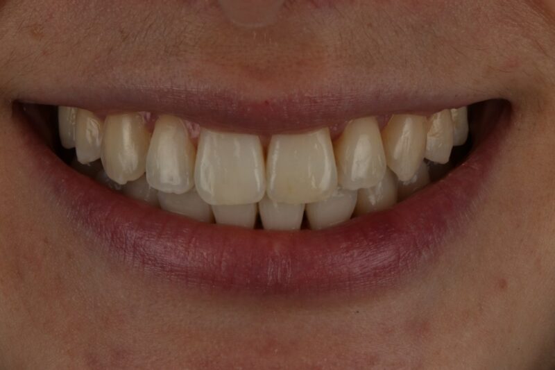 After - Cheadle Hulme Dental