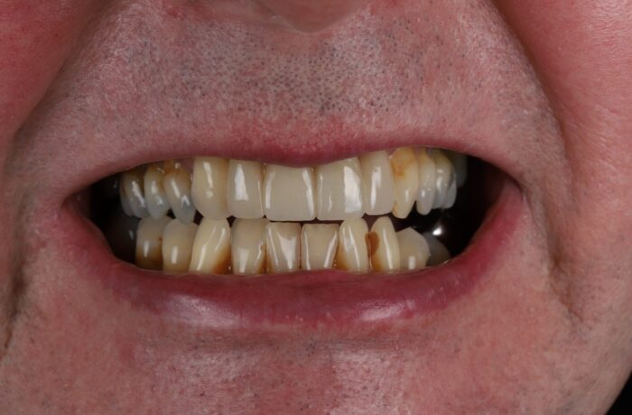 After - Cheadle Hulme Dental