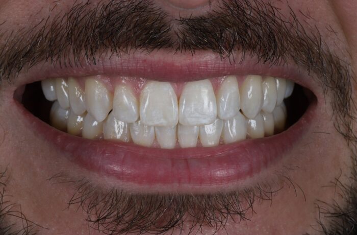 Before - Cheadle Hulme Dental