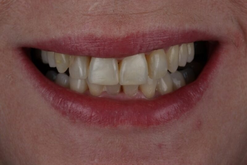 After - Cheadle Hulme Dental