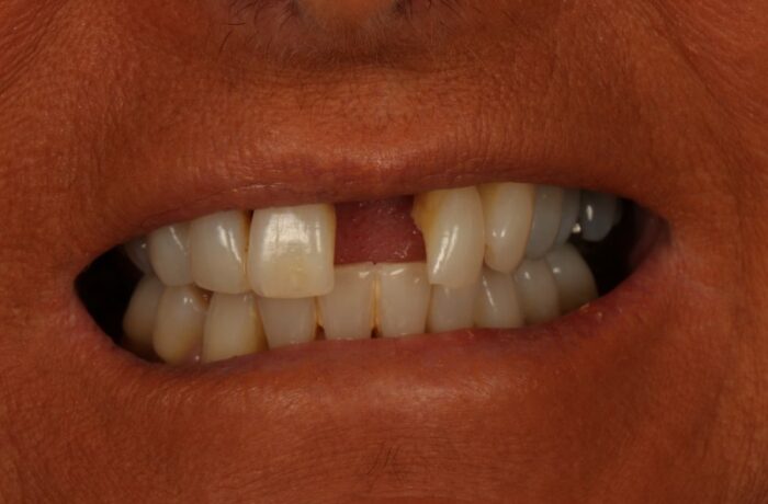 Before - Cheadle Hulme Dental
