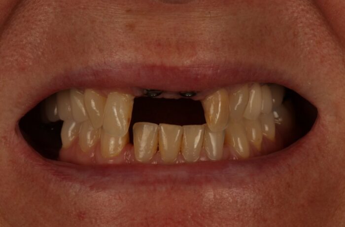 Before - Cheadle Hulme Dental