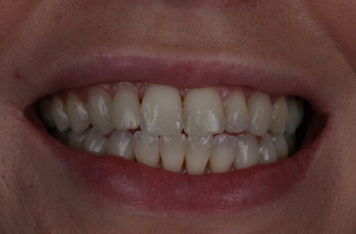 After - Cheadle Hulme Dental