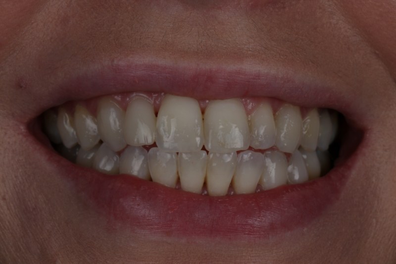 After - Cheadle Hulme Dental